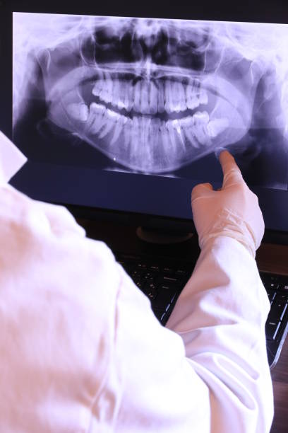 Best Broken or Cracked Tooth Emergency Dentist in Belmar, NJ
